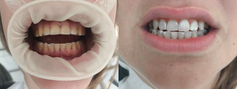 Witness the dazzling difference - Dentist in Turkey
