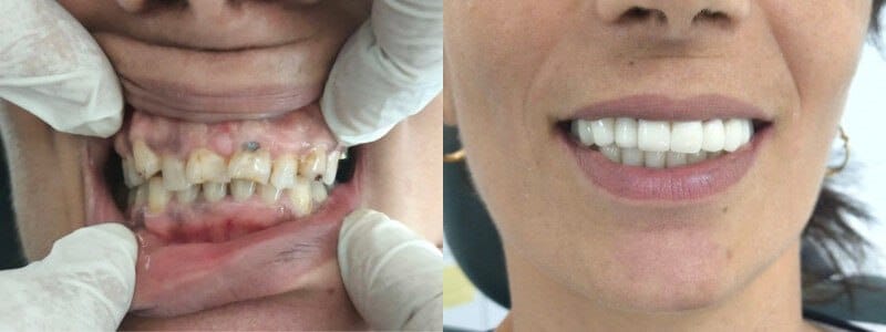 Your trusted dentist in Turkey